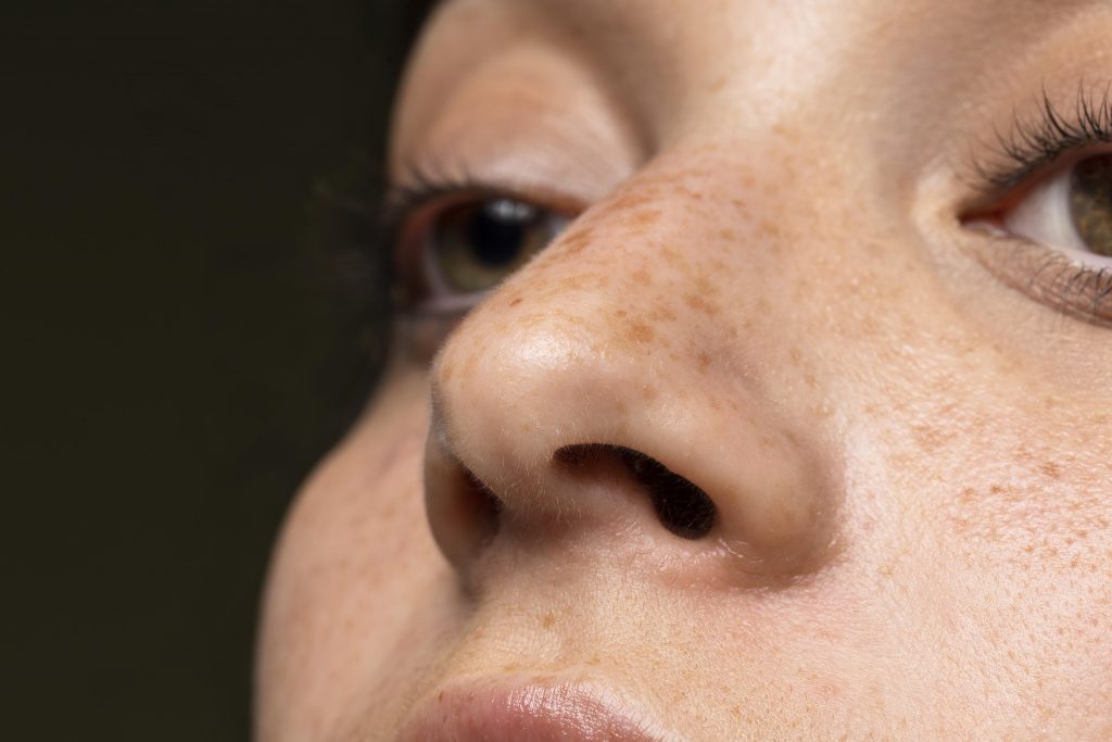 close up woman with freckles